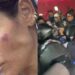 Emboscada en San Cosme: golpean a alcaldesa de Cuauhtémoc durante operativo
